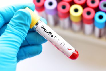 hepatit c